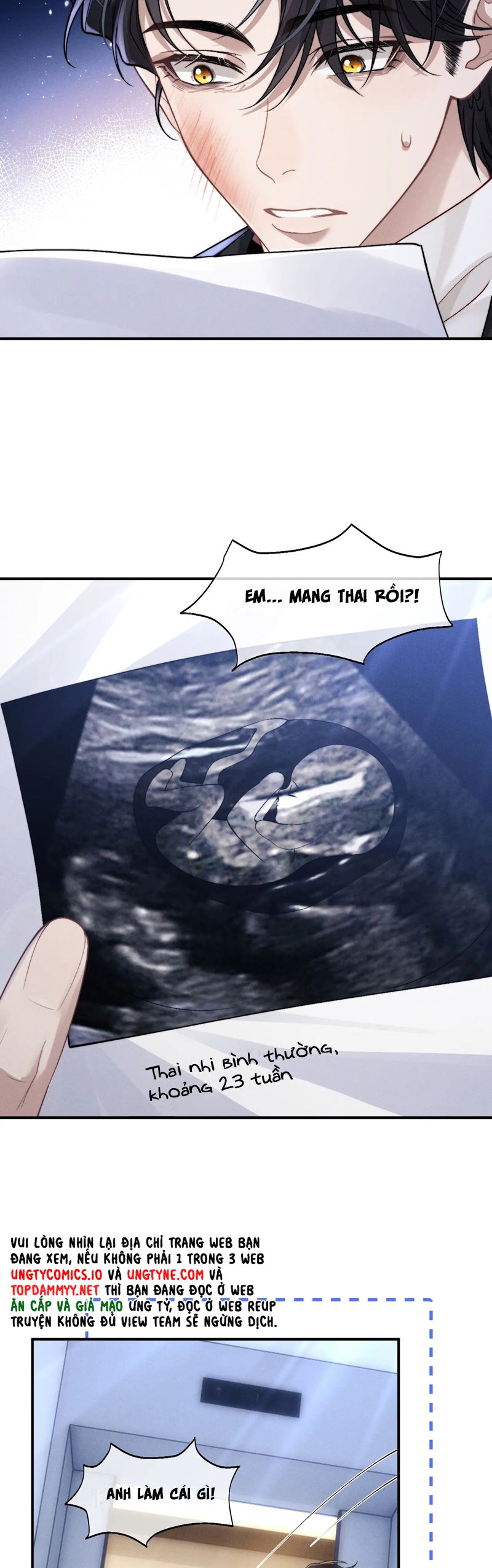 Chấp Sự Thỏ Cụp Tai Chapter 130 - Trang 4